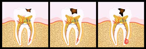 Oralchirurgie Oralchirurgie