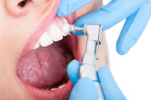 Prophylaxemaßnahmen und Prävention Prophylaxemaßnahmen und Prävention